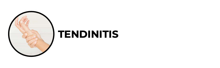 Tendinitis